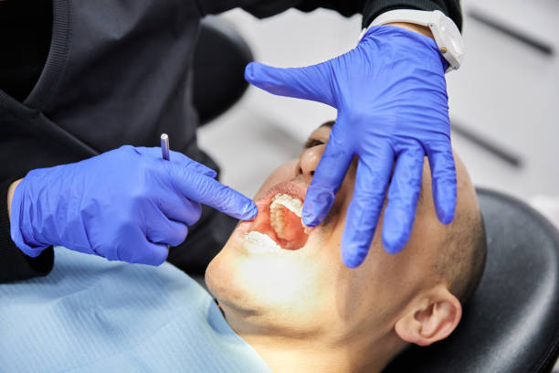 Best Emergency Tooth Extraction in Mlstadt, IL