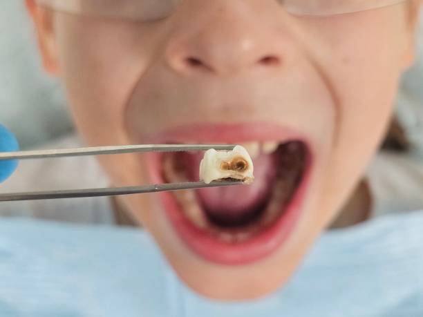 Best Emergency Treatment for Toothache in Mlstadt, IL