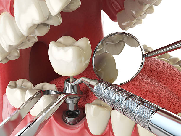 Best Emergency Orthodontic Repairs in Mlstadt, IL